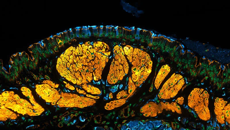 42 nagrađene fotografije s Nikonovog natjecanja u fotomikrografiji Small World otkrivaju skriveni svemir - 15