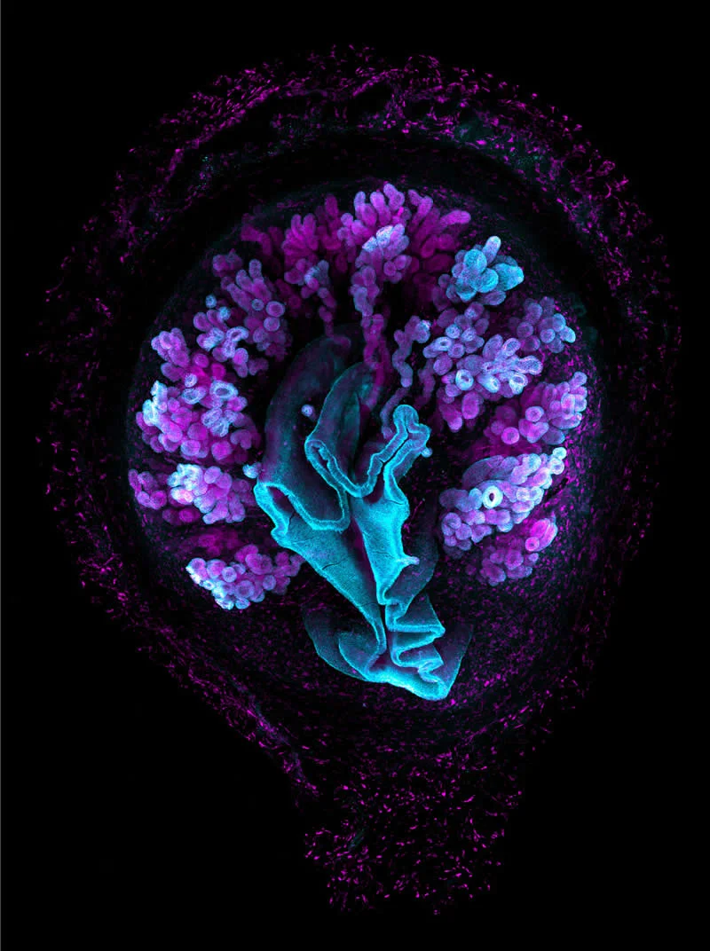 42 nagrađene fotografije s Nikonovog natjecanja u fotomikrografiji Small World otkrivaju skriveni svemir - 21